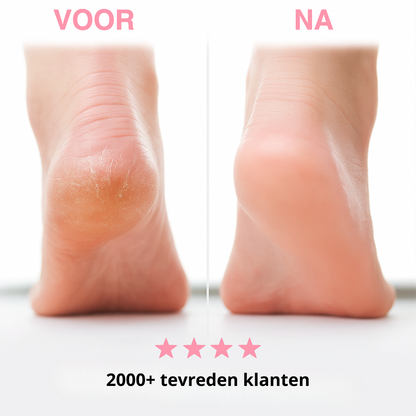 SmoothPro