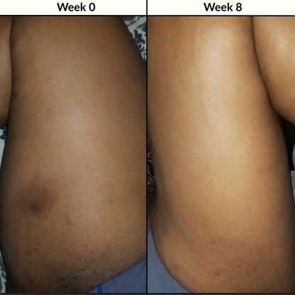 Kurkuma & Kojic Zeep voor een Egale Huid