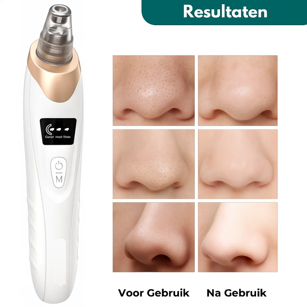 Vacuüm Mee-eter Verwijderaar