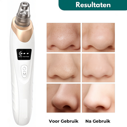 Vacuüm Mee-eter Verwijderaar