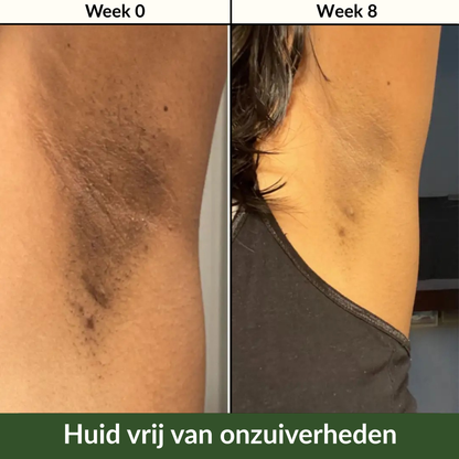 Kurkuma & Kojic Zeep voor een Egale Huid