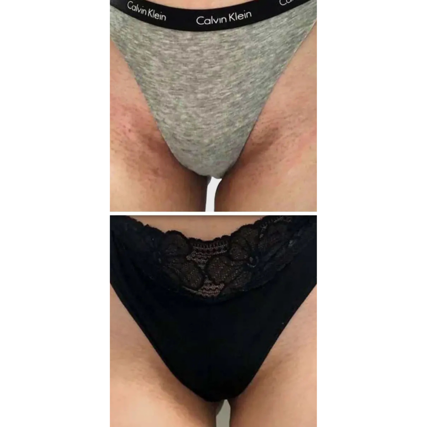 Kurkuma & Kojic Zeep voor een Egale Huid