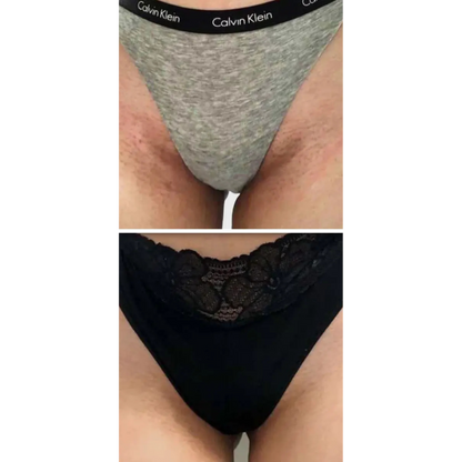 Kurkuma & Kojic Zeep voor een Egale Huid