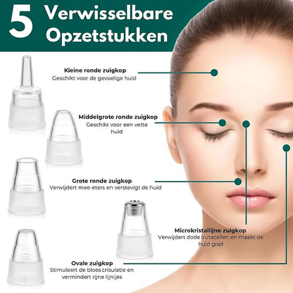 Vacuüm Mee-eter Verwijderaar